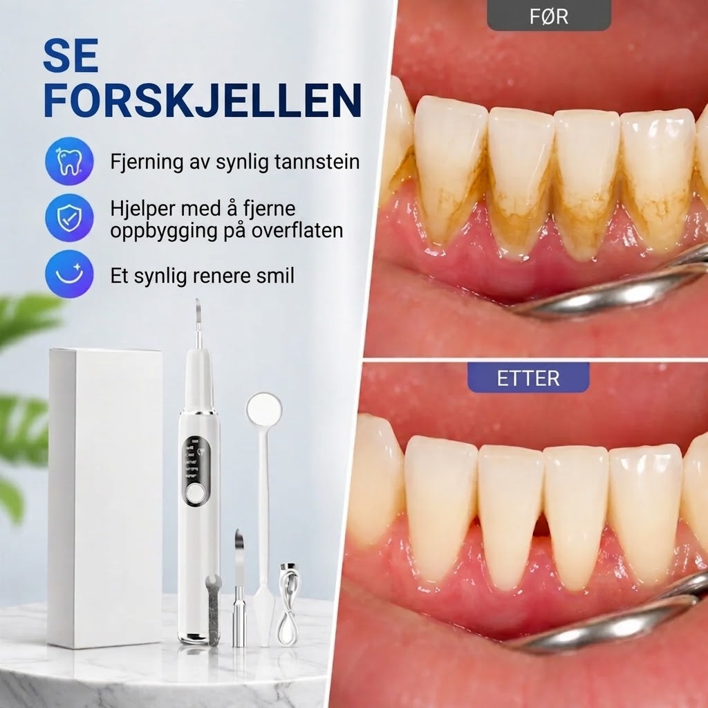 Bærbart ultralyd-tannrenser og tannsteinfjerner-sett