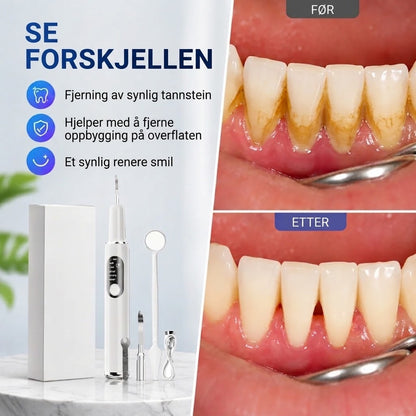 Bærbart ultralyd-tannrenser og tannsteinfjerner-sett