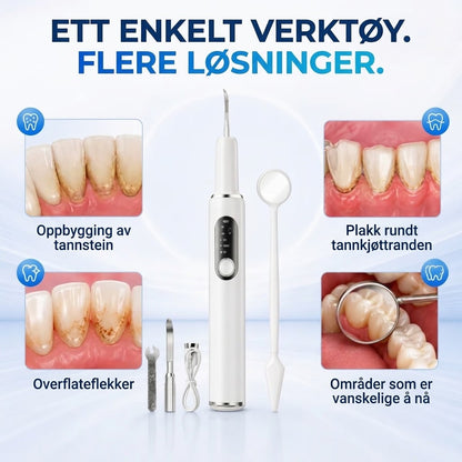 Bærbart ultralyd-tannrenser og tannsteinfjerner-sett